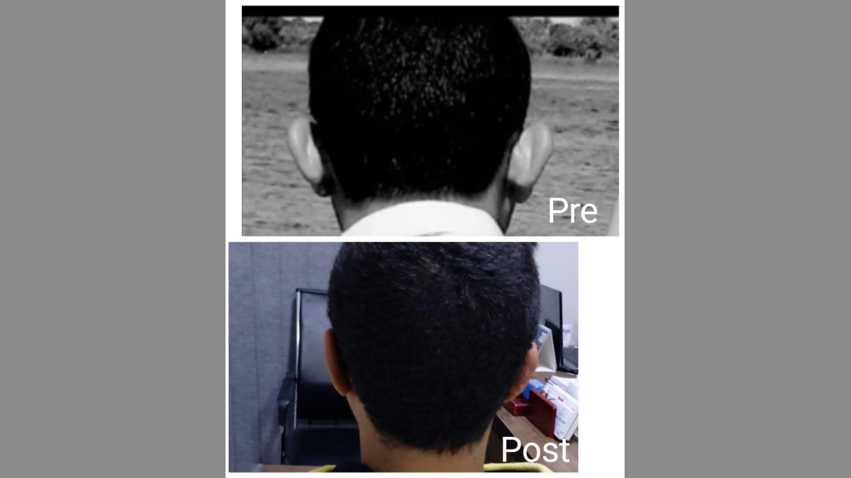 دكتور تجميل الأذن في الغردقة